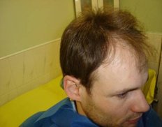 Slider image (3) Vita Hair | Clinica Capilar